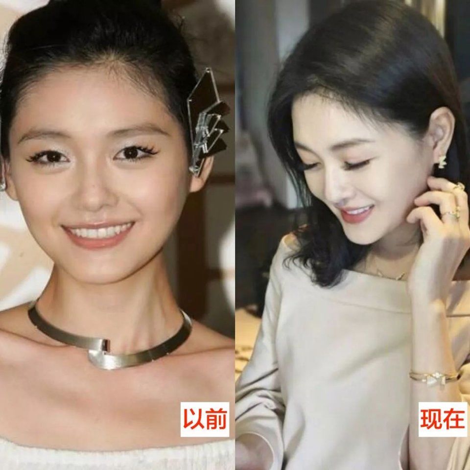 曝大S童年"黑"历史,拼命美白会有害健康么?