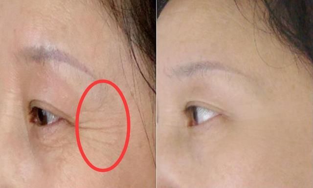 诊所57岁女大夫:诊所常“断货”药膏，睡前抹一抹，去皱还美白