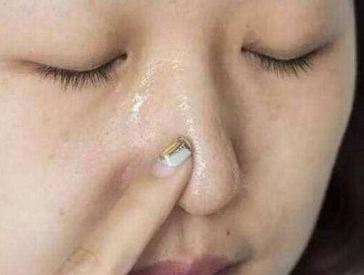 敷面膜用乳霜就长痘?可能你在喂养螨虫!