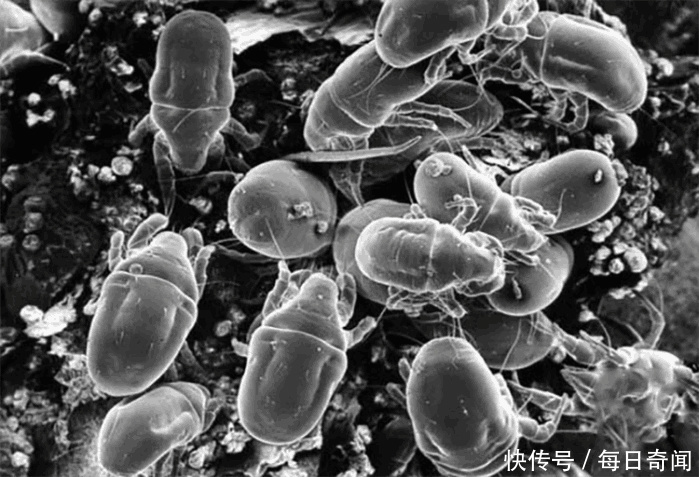 皮肤变成螨虫窝竟浑然不知,3方法教你自检,十试九中2招根除