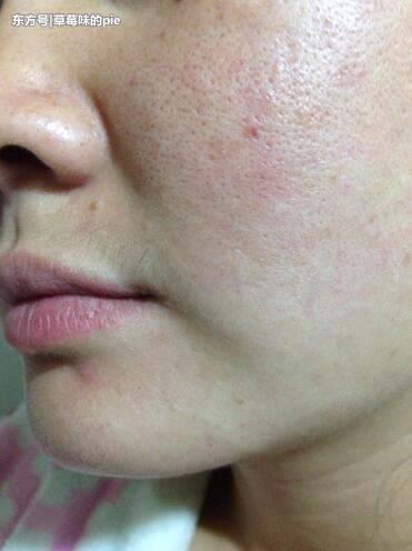 毛孔里的小颗粒怎么都挤不完，只要碰上这3物,搓一搓很快就消失