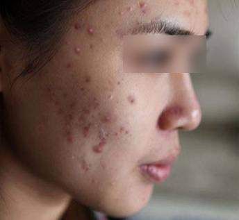 小姐姐注意!这几款面膜会导致面部萎缩，快检查你有没有买过!