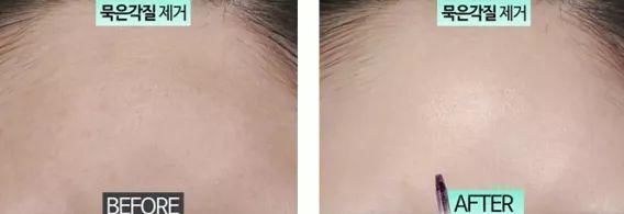 张韶涵又双叒叕种草了!10秒洗出角质、死皮，温和去角质...