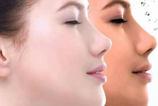 夏季“晒”黑怎么办？厨房中这3样，让你1周快速变白