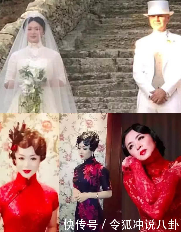 又见金星机场秀，脸部浮肿不见女人味，没有玻尿酸的脸也崩了！