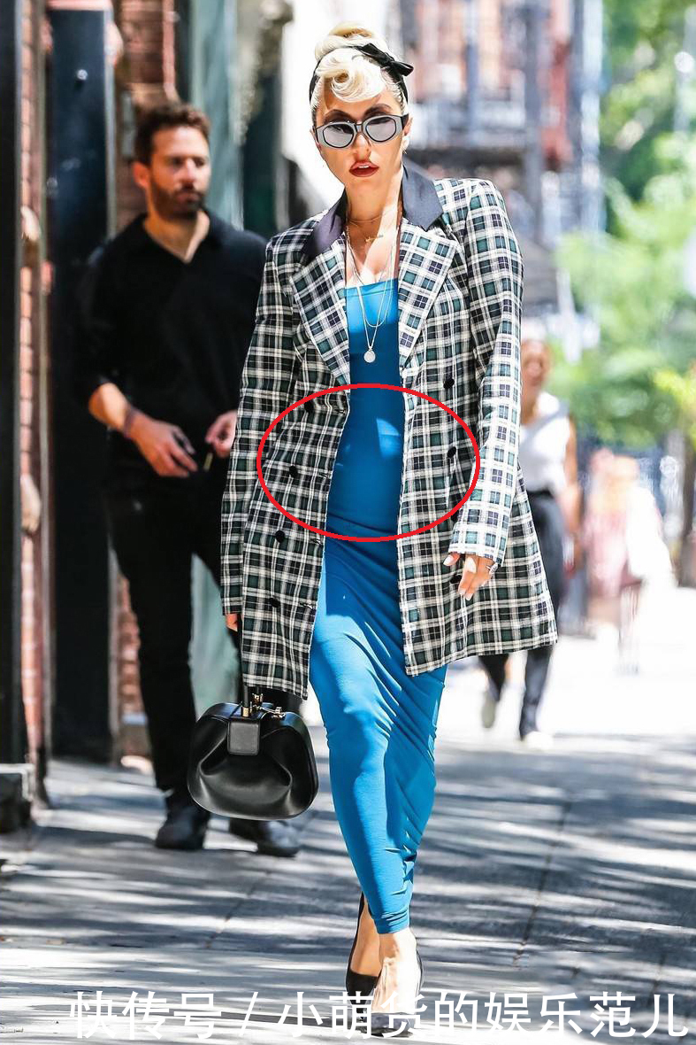 LadyGaga出街，小肚子鼓好高太抢镜，网友：里面是真实存在的吗？