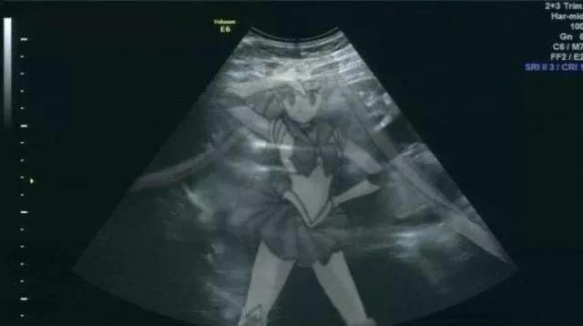 给男朋友发消息说"我好像怀孕了"，网友的评论太精彩了