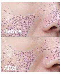 告别毛孔烦恼 HomeFacialPro新品乳糖酸原液测评