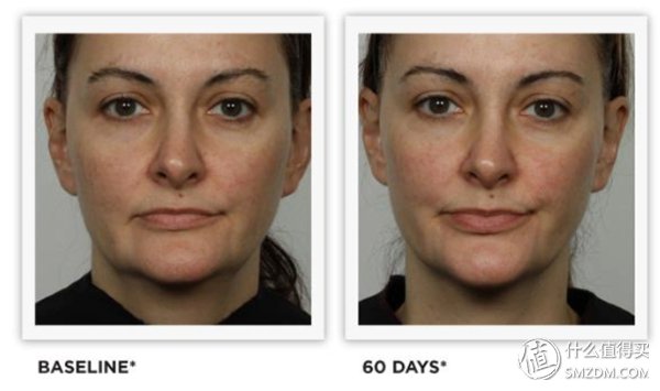 热门美容仪逐点评，真正值得投资的产品是哪个?