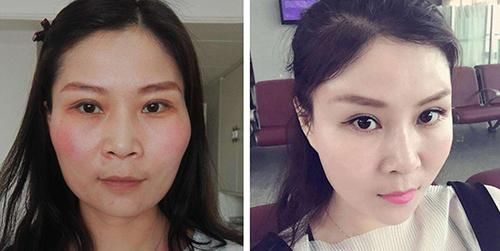  变废为宝■变废为宝，自体脂肪还有这些妙用，你都知道吗？