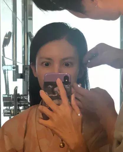  血管型黑眼圈@当妈后黑眼圈明显加重？黑眼圈不是病，挂在眼睛上真“要命”