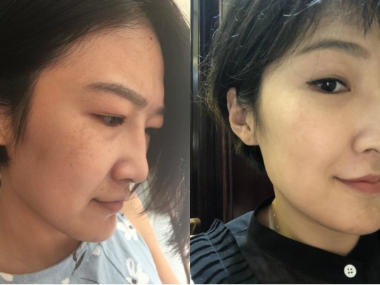 简柚:健康抗衰老神器!不去美容院也能让皮肤变年轻