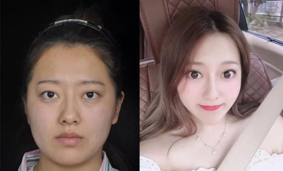 『后12小时内』假期术后注意事项大全!