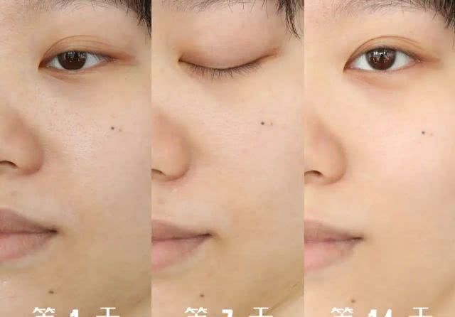  「网传」网传的护肤“黑科技”真的可以养出素颜无瑕肌吗？