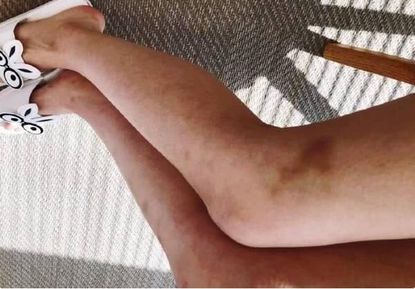 拍戏随身带安全套？林允微博晒出实锤澄清误会